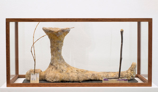 Emil Westmann Hertz: Forever Altered
