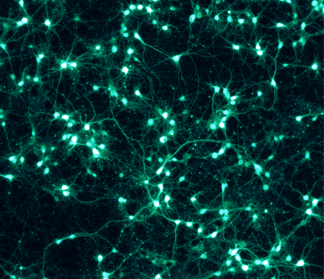 Neuroner. Kilde: Wikimedia Commons