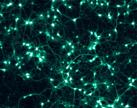 Neuroner. Kilde: Wikimedia Commons